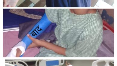 Photo of चिरायु से 10 वर्षीय सीमा के जन्मजात विकृति का हुआ निःशुल्क ऑपरेशन।